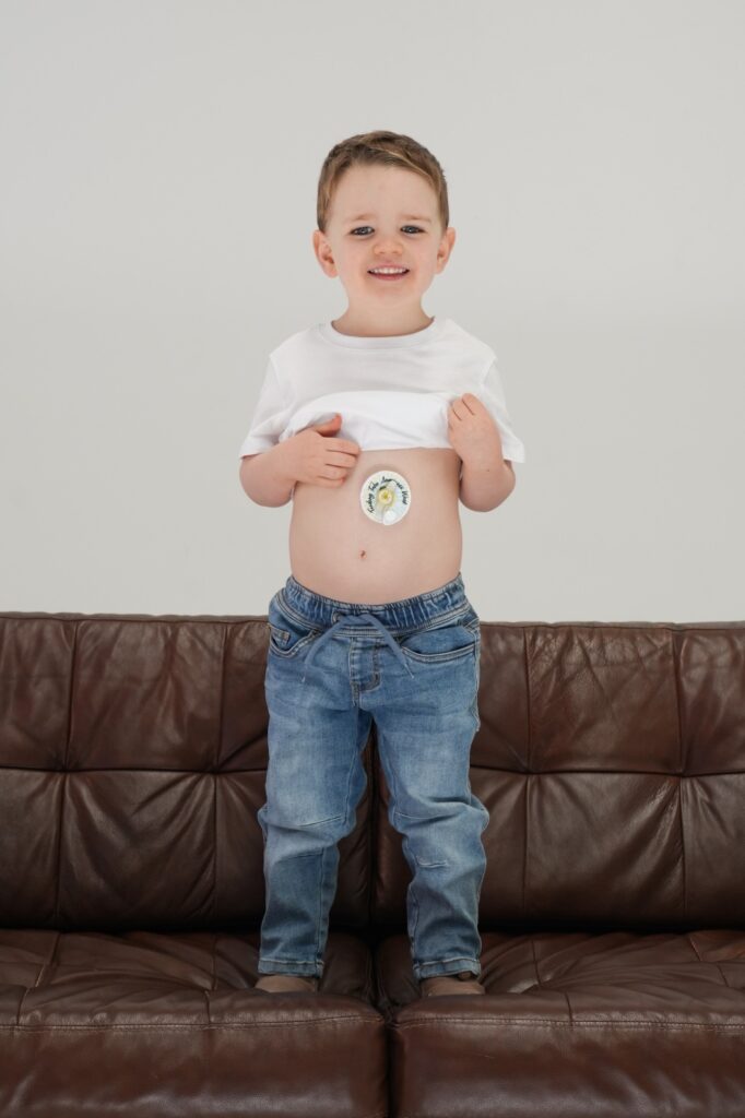 tube feeding australia